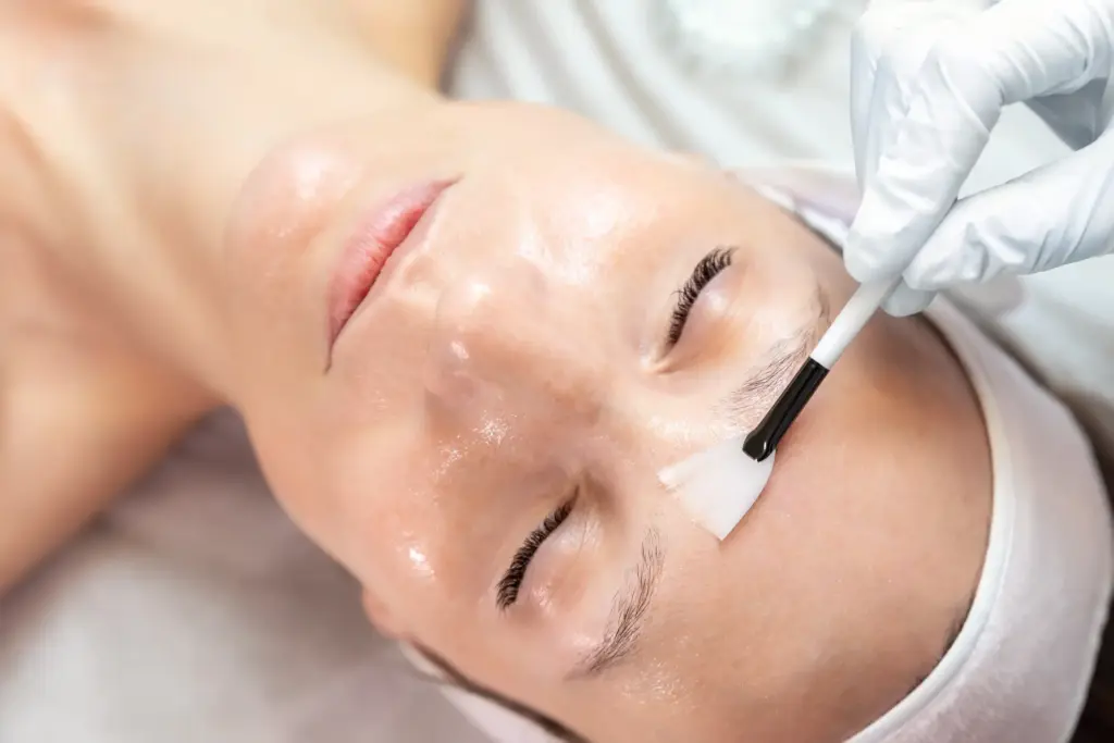 Professional chemical peel services at Icon Aesthetics