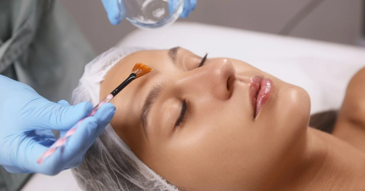 Professional application of a chemical peel solution on a patients face for anti-aging and skin resurfacing at Icon Aesthetics